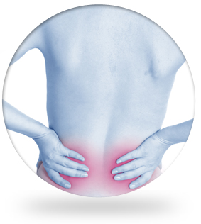 Sciatica